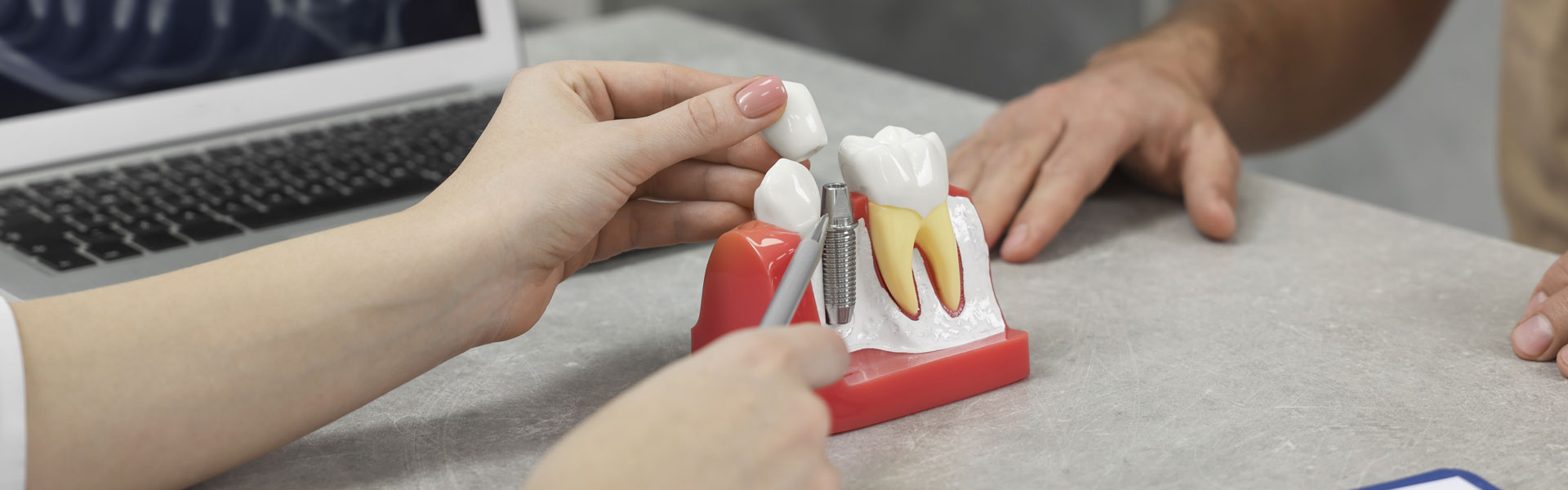 Dental Implants Near You in Westport, CT