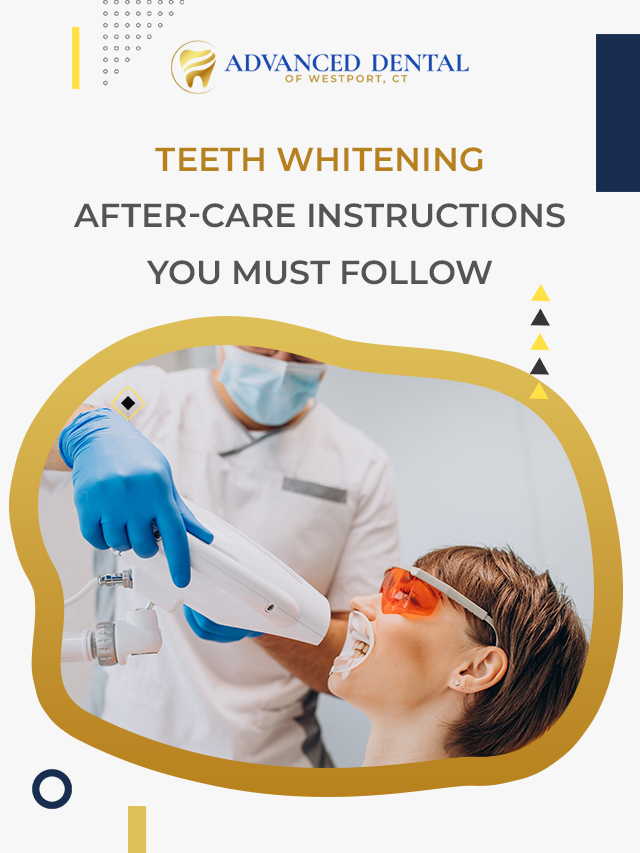 Teeth Whitening After-Care Instructions You Must Follow