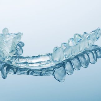 Invisalign Treatment